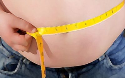 Obesidade na adolescência aumenta risco de câncer no intestino, diz estudo