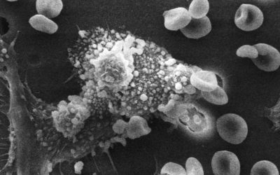 Japoneses desenvolvem sensor capaz de detectar câncer pelo hálito
