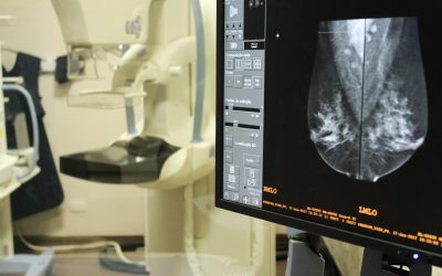 Hospital de Câncer oferece mamografias gratuitas em 2017